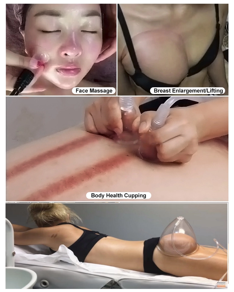 body massager vacuum therapy butt lift enlargement machine with 35 cups buttock lifting breast enlargement machine