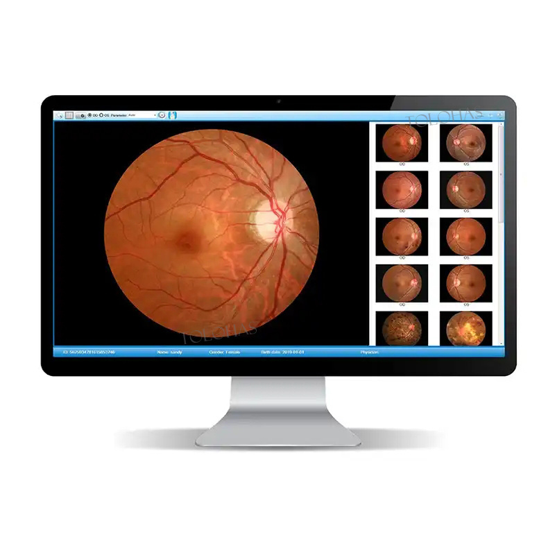 LHV650A Hospital Ophthalmic Equipment Retinal Camera Digital Non-mydriatic Eye Fundus Camera