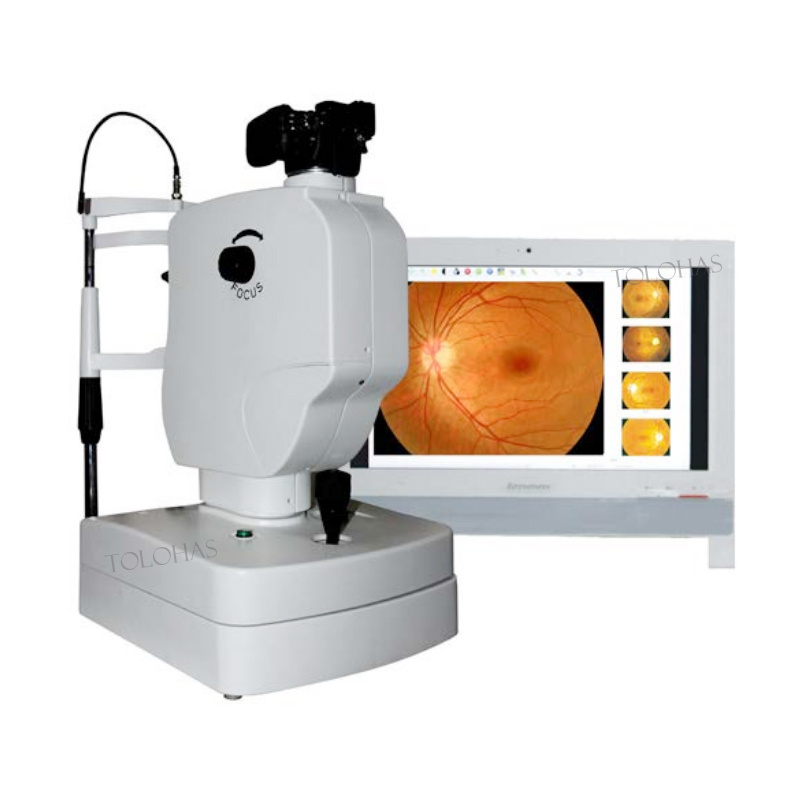 LHV650A Hospital Ophthalmic Equipment Retinal Camera Digital Non-mydriatic Eye Fundus Camera