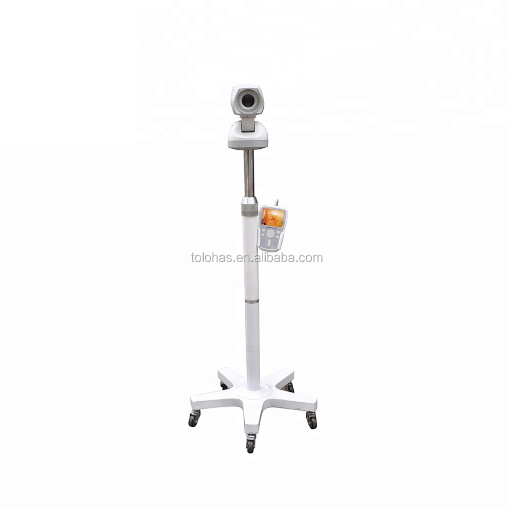 LH9800A Full HD Camera Directly Diagnosis Colposcope Price Electronic Beautiful Vagina Colposcope Camera