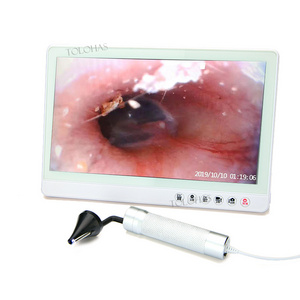 LHGK03 Digital ENT Ear Camera Endoscope Otolaryngology Examination Eardrum Visible Video Otoscope Set