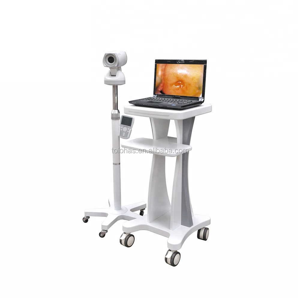 LH9800A Full HD Camera Directly Diagnosis Colposcope Price Electronic Beautiful Vagina Colposcope Camera