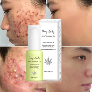 Best natural organic remove acne scars bio serum gel scar light acne free cream