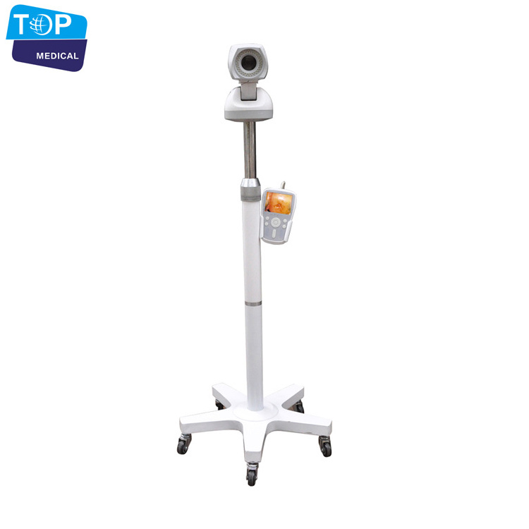 Medical Digital video colposcope / full hd camera for vagina colposcope price