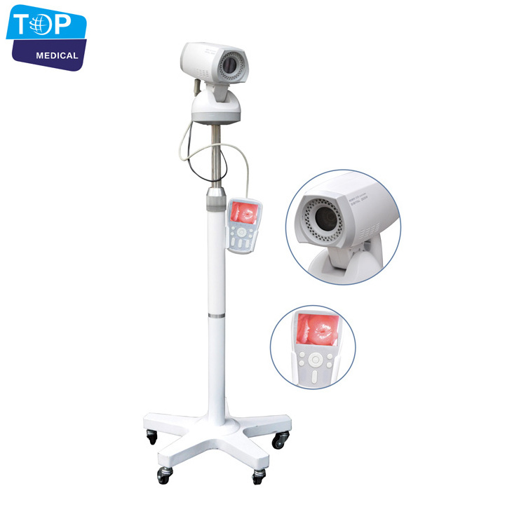 Medical Digital video colposcope / full hd camera for vagina colposcope price