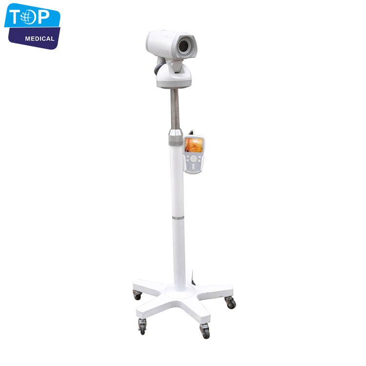 Medical Digital video colposcope / full hd camera for vagina colposcope price