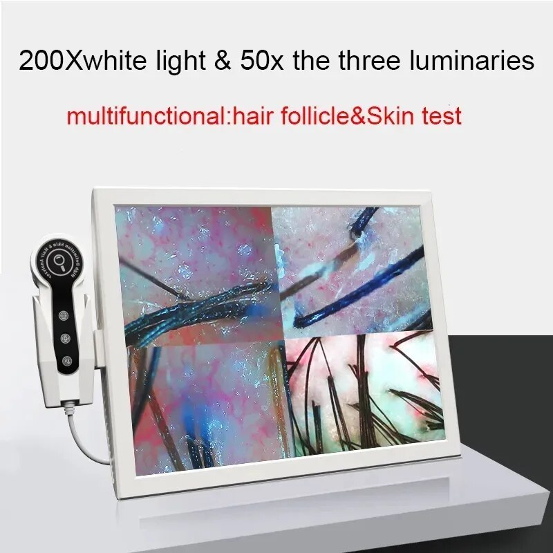 15 Inch Digital HD Screen Home Use Skin and Hair Analyzer Help You Analysis Of Skin And Analysis Scanner Freeze Fixed