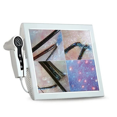 15 Inch Digital HD Screen Home Use Skin and Hair Analyzer Help You Analysis Of Skin And Analysis Scanner Freeze Fixed