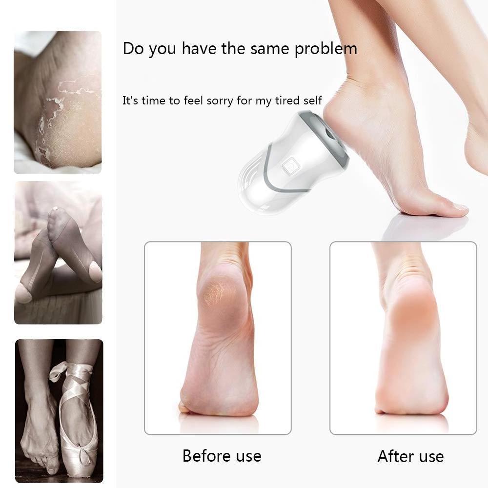 Portable Electric Feet Callus Removers Rechargeable Foot Grinder File Pedicure Tools for Dead Hard Cracked Dry Skin