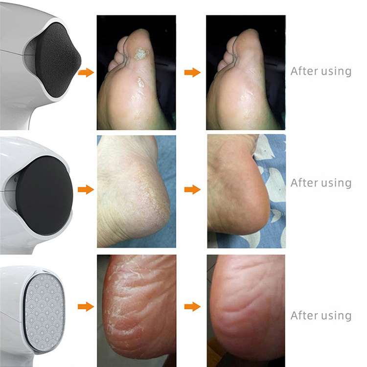 Wholesale USB Cordless Foot Grinder Pedicure Rechargeable Electric Foot File Callus Remover