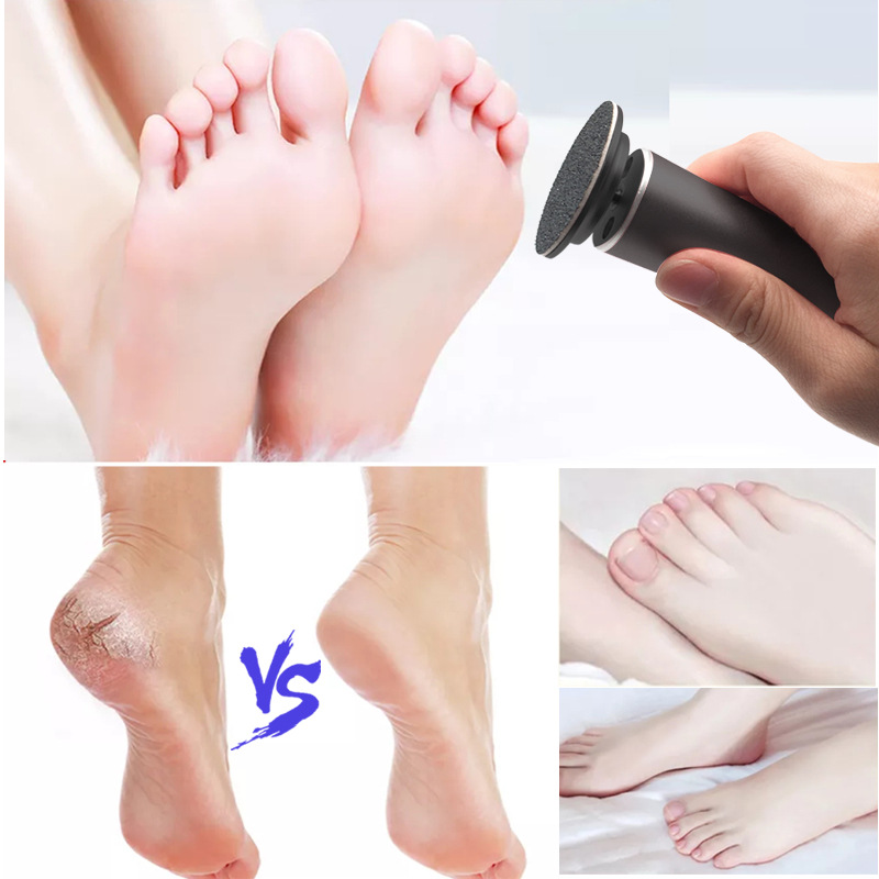 New Foot Care Tool Feet Grinder Professional Dead Skin Remover  Electric Callus Remover For Feet