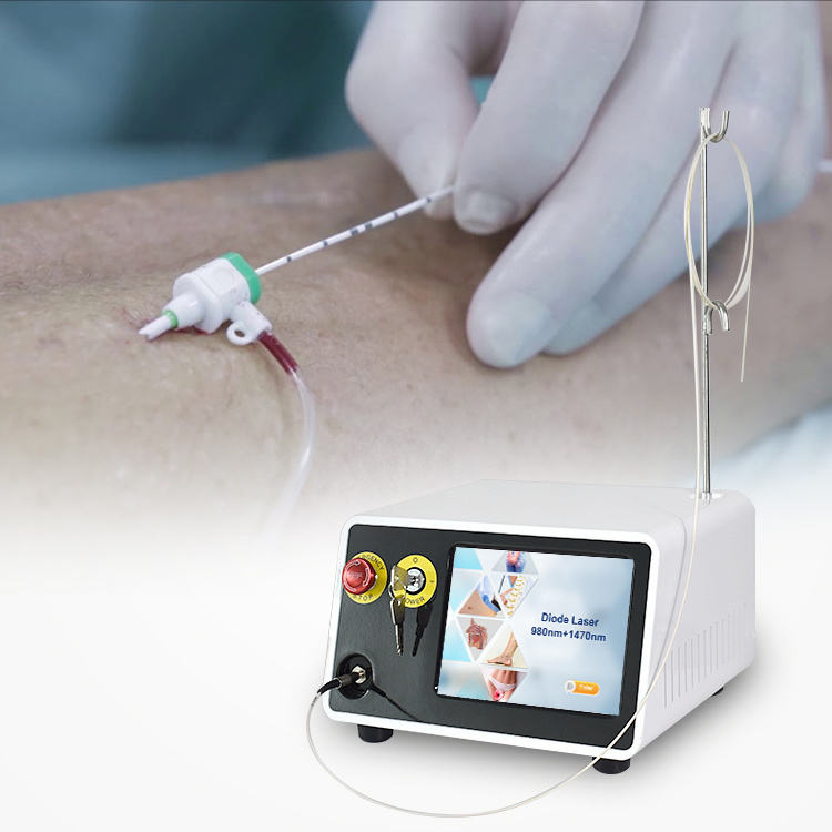 2023 Top sale 980nm 1470nm Machine Endovenous Diode Laser Laser varicose veins Vascular Removal Machine