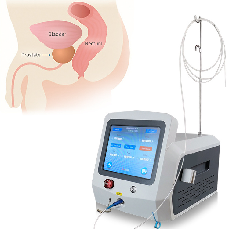 Diode Laser Machine 980nm 1470nm Potent Medical Therapy Prostate Urology Surgery For BPH