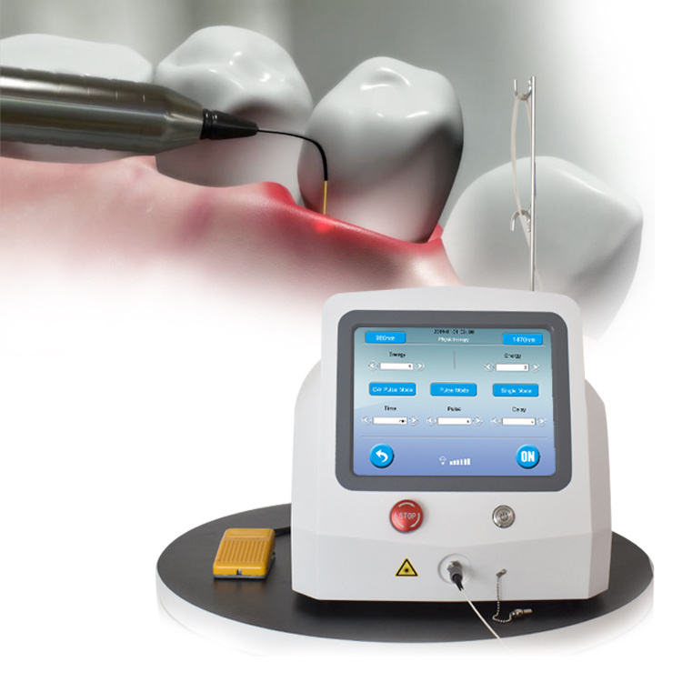 2024 new 980nm/1470nm diode dental laser machine teeth whitening laser