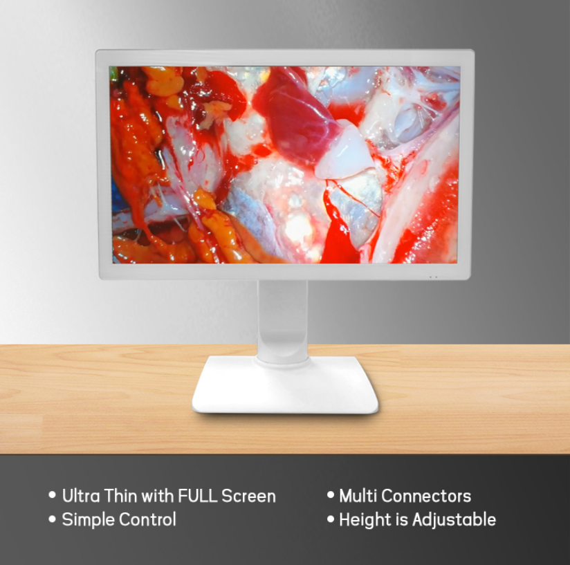 TUYOU HOT Sale 24-inch Full HD LCD Surgical Medical Grade Monitor for Laparoscopic