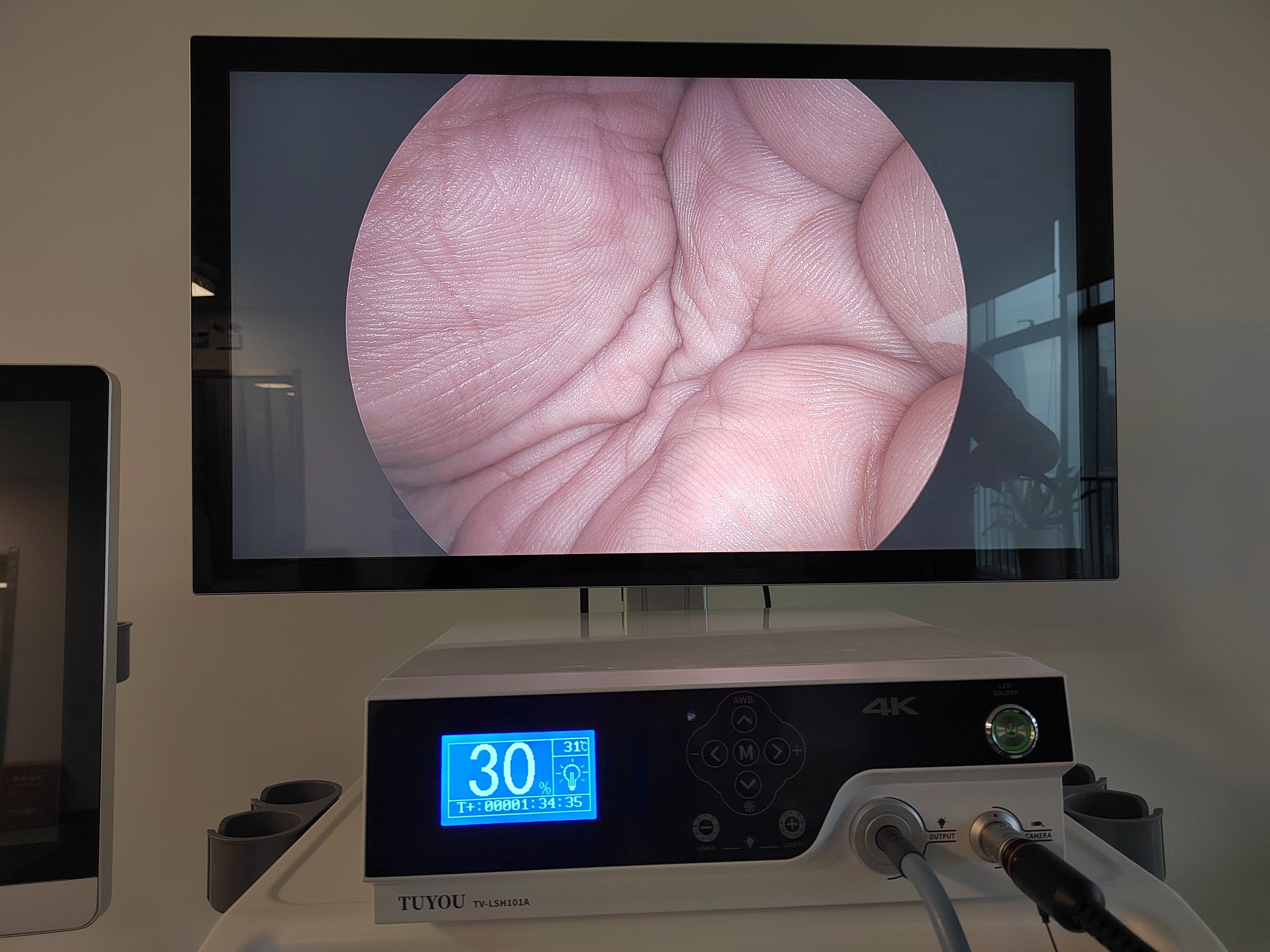 4K 32 Inch Medical Grade Monitor