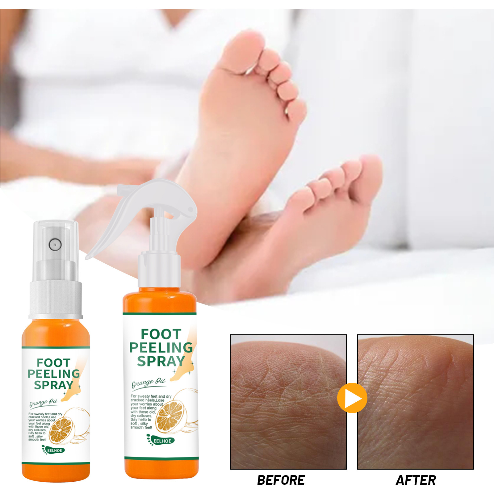 2023 Popular Nourishing Tender and Bright Foot Callus Heel Elbow Knee Dead Skin Removing Foot Peeling Spray