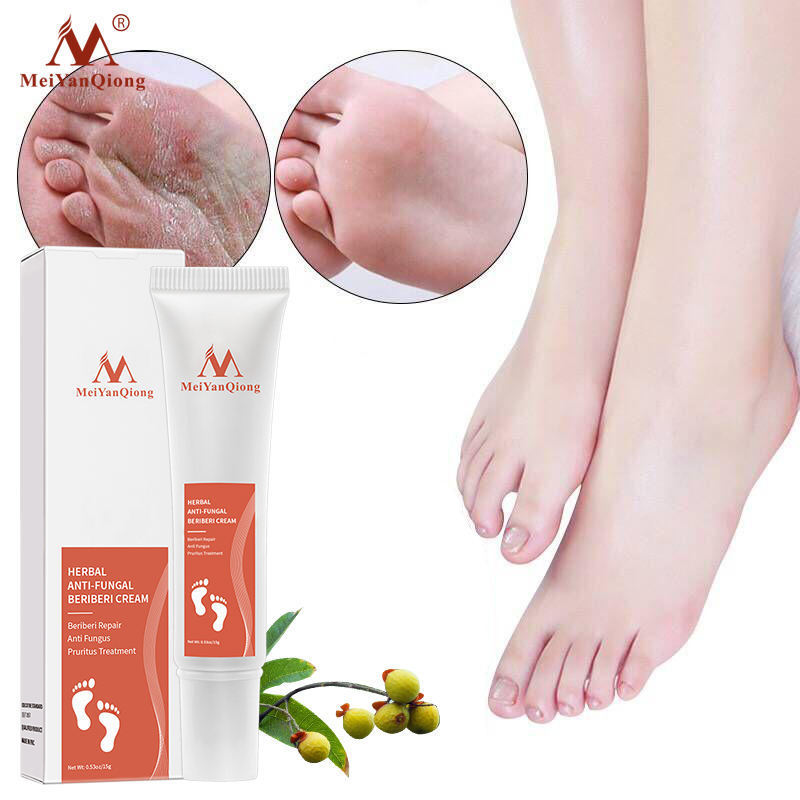 tiktok Hot Anti Fungal Nourishing Relieve Beriberi Treatment Cream Exfoliating Smooth Nail Repair Cream