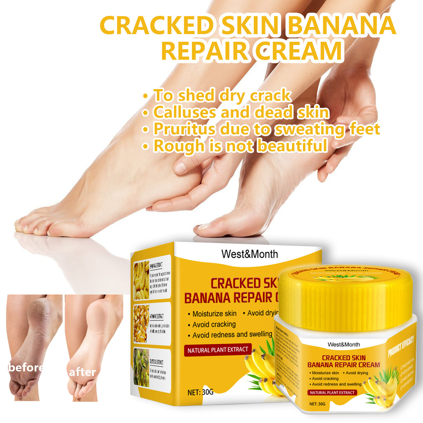 Hand and foot repair cream to remove dead skin calluses nutrition moisturizing softening horny skin care cream