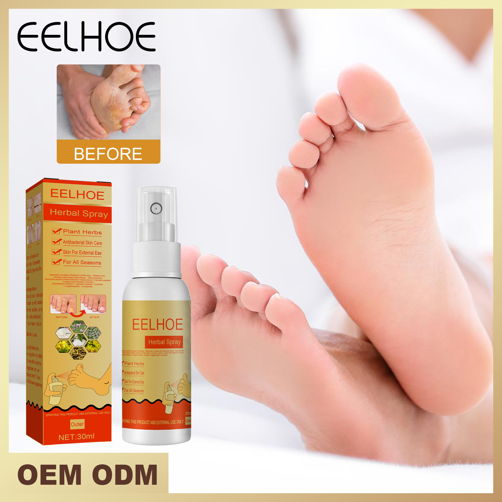 High quality foot care spray that can remove foot sweat and smelly foot odor and stop itching and bacteria wholesale