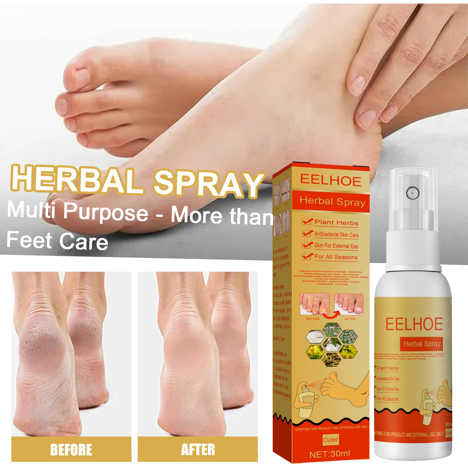 High quality foot care spray that can remove foot sweat and smelly foot odor and stop itching and bacteria wholesale