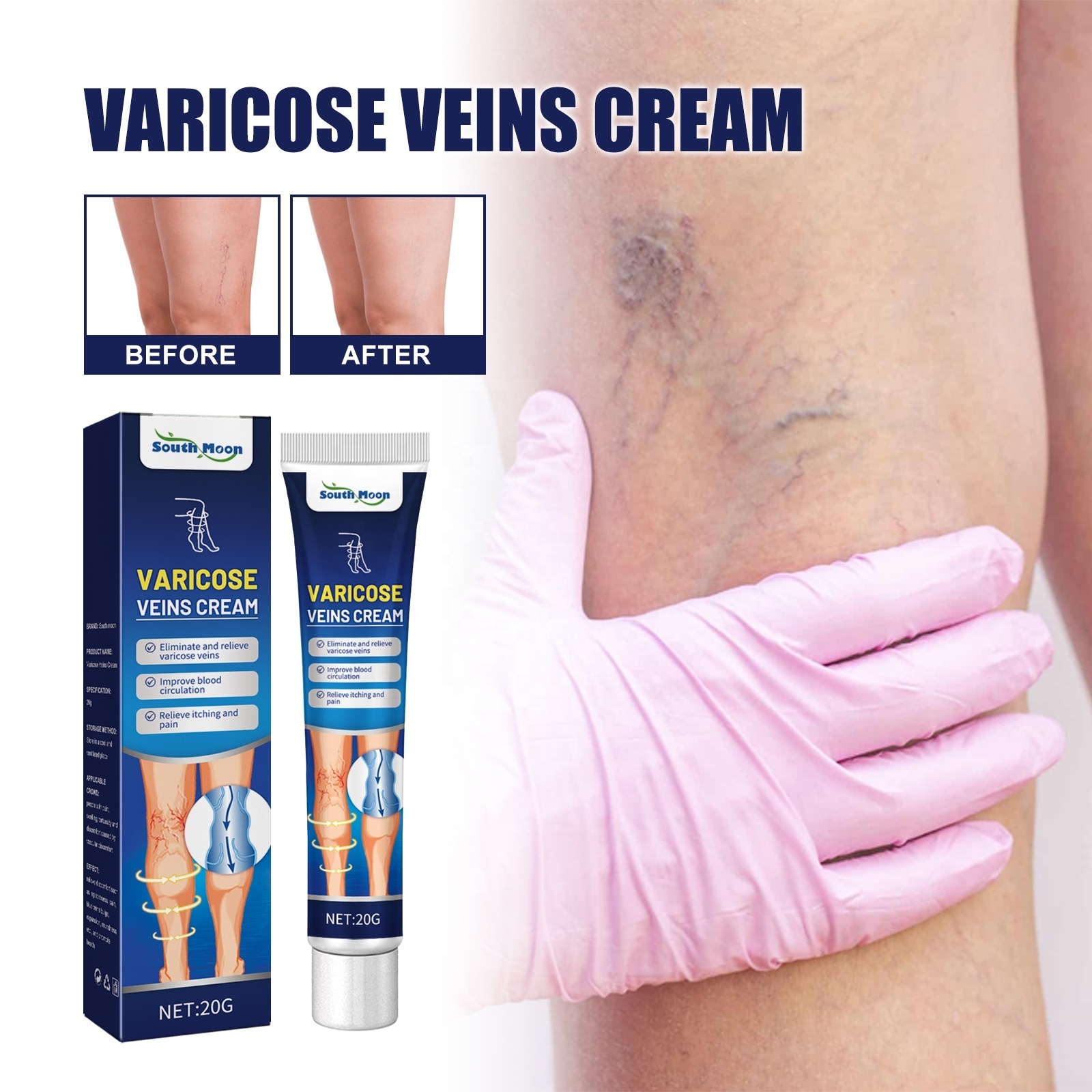 Free shipping Varicose Veins Relief Cream Vasculitis Phlebitis Spider Pain Relief Ointment Medical Plaster Body Care