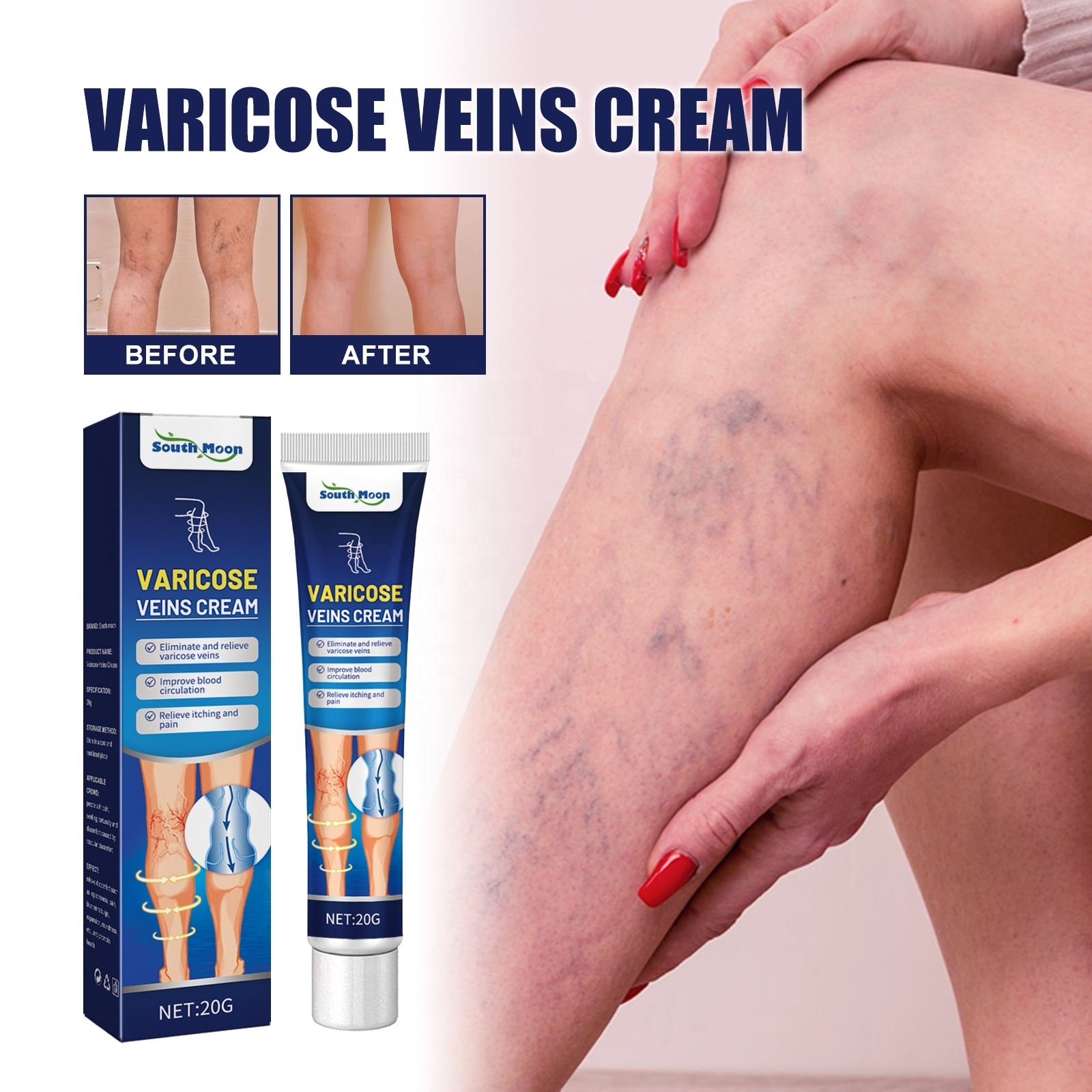 Free shipping Varicose Veins Relief Cream Vasculitis Phlebitis Spider Pain Relief Ointment Medical Plaster Body Care