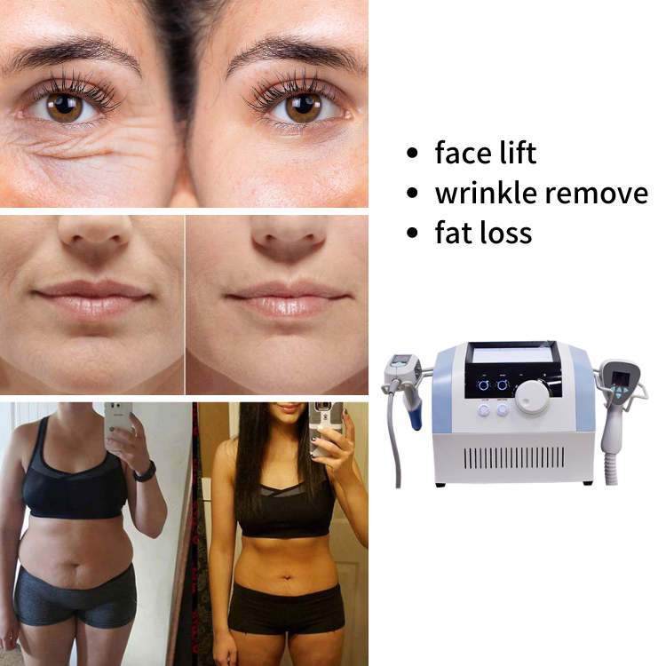 Hot Selling bbl Exilie Ultra 360 2 In 1 Rf Ultrasound Skin Tightening Weight Loss Machine