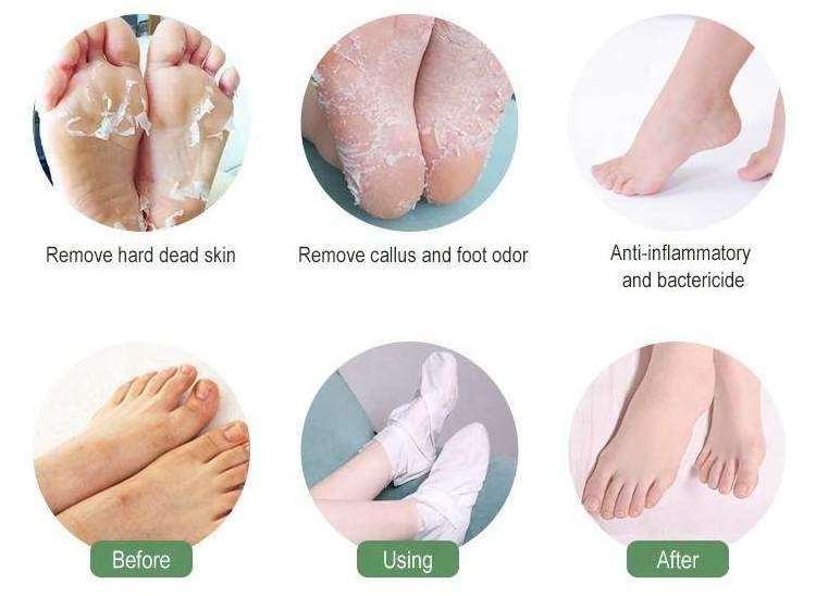 Wholesale  Callus Removal Foot Peel Mask Socks Moisturizing Pedicure Exfoliating Peeling Foot Mask