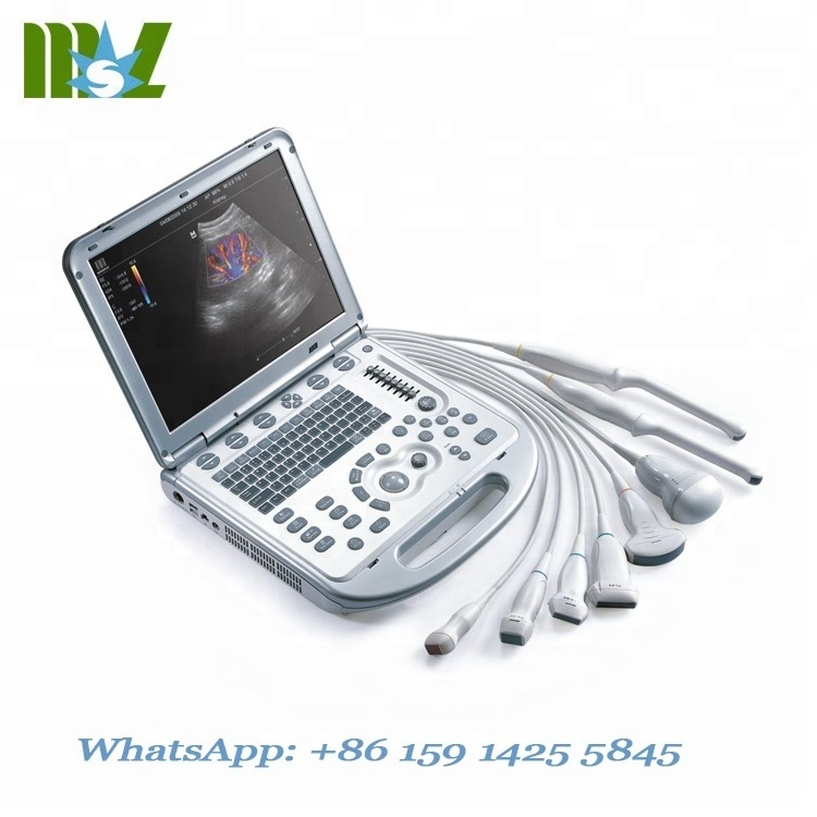 China manufacture mindray M7 M5 M9 portable color doppler ultrasound machine price