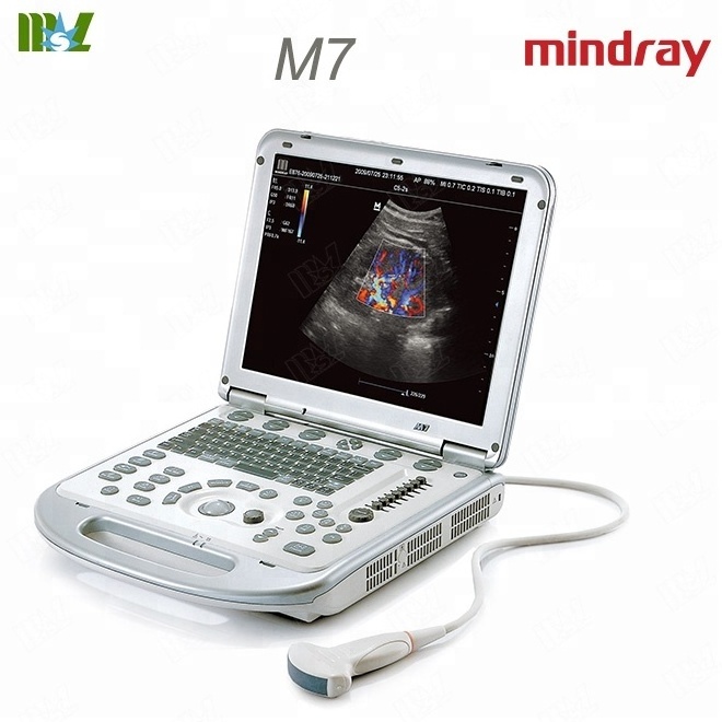 China manufacture mindray M7 M5 M9 portable color doppler ultrasound machine price