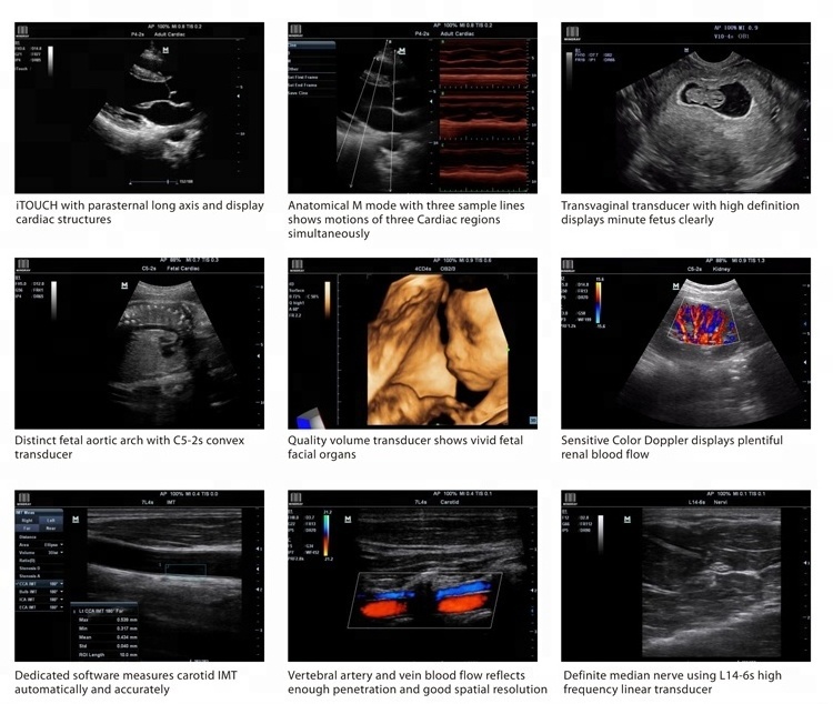 China manufacture mindray M7 M5 M9 portable color doppler ultrasound machine price