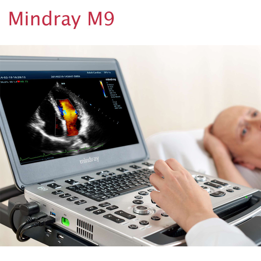 Mindray M9 better than Mindray M7 4D ultrasound machine/ cardiac inspection primary choice doppler ultrasound machine