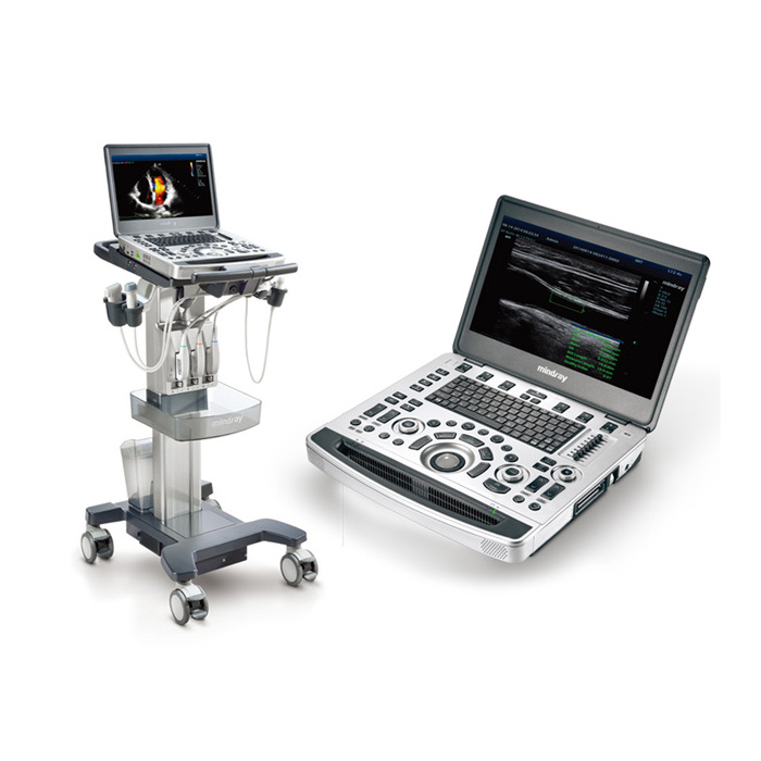 Mindray M9 better than Mindray M7 4D ultrasound machine/ cardiac inspection primary choice doppler ultrasound machine