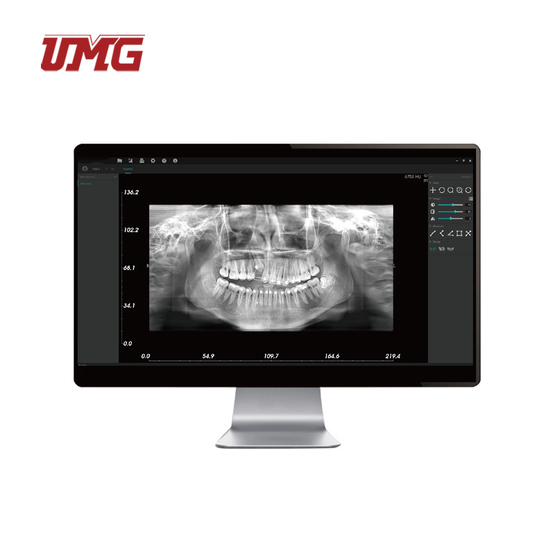 Dental Panorama Xray Cephalometric Digital Panoramic 3D X Ray Machine