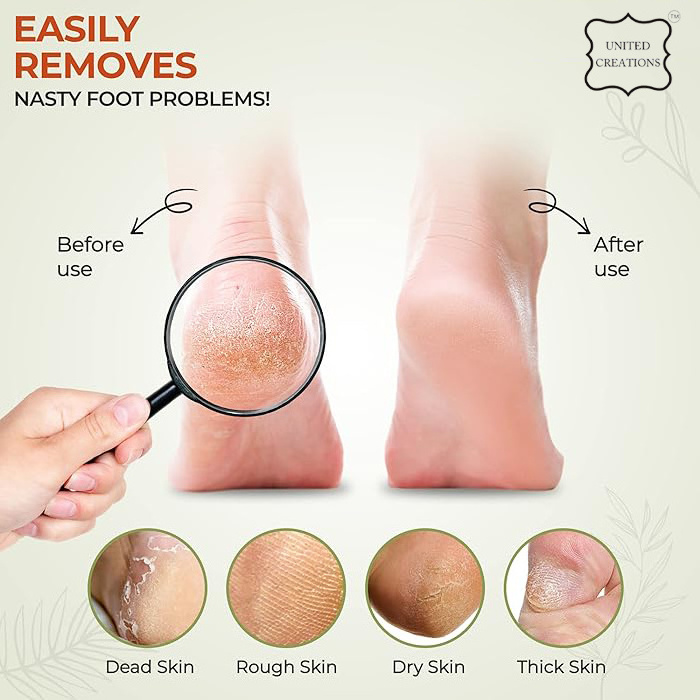 Professional Foot Scrubber for Hard Skin - Premium Quality Foot Scraper & Callus Remover for Feet Leaving Heels Soft & Smooth