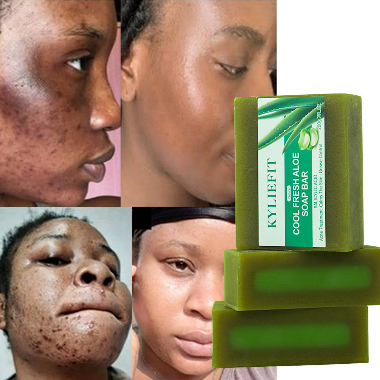 Salicylic Acid Cool Fresh Aloe Soap Pore Clean Exfoliating Acne Fighting Softening Skin Anti-Blemish Skin Care Soap