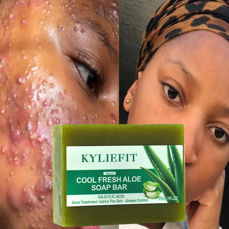 Salicylic Acid Cool Fresh Aloe Soap Pore Clean Exfoliating Acne Fighting Softening Skin Anti-Blemish Skin Care Soap