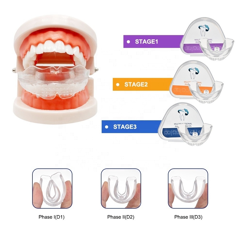 Teeth Orthodontic Trainer Retainer Braces Smile Straighten Dental Adult Child Teeth Braces For Sale