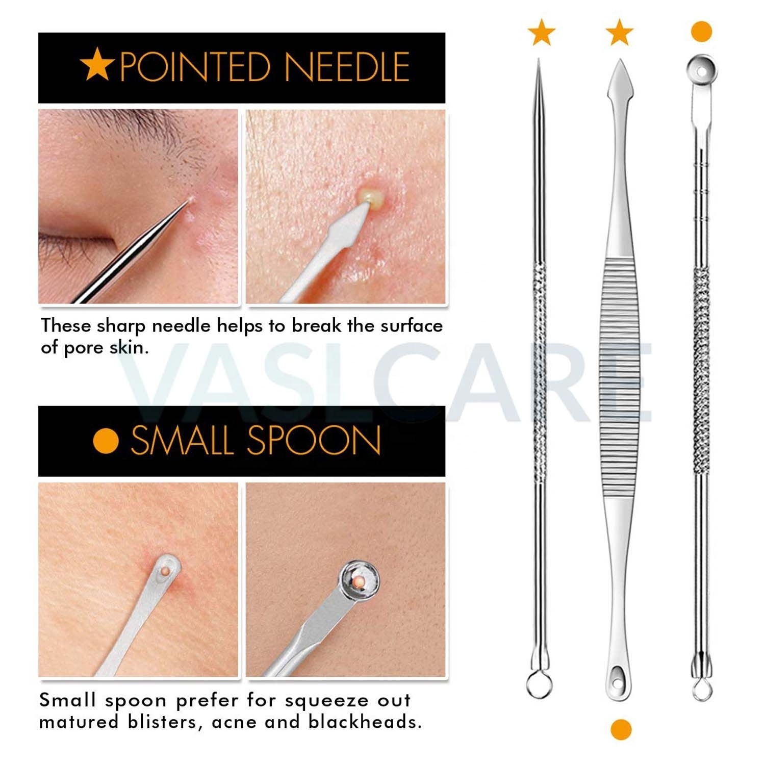 Blackhead Facial Acne Kit  Comedone Extractor Spot Treatment Blemish Whitehead Popping Tool Tweezer Set of 7 Pcs by Vaslcare