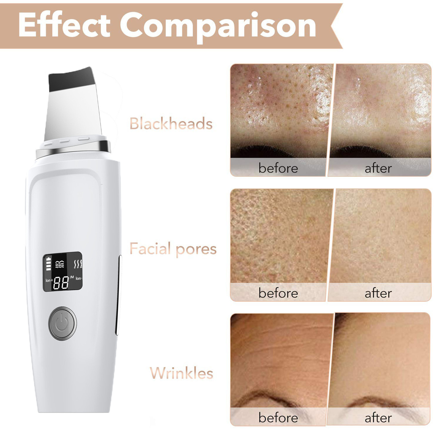 Comedones Extractor Deep Cleansing Skin Spatula Pore Cleaner Ultrasonic Facial Scrubber