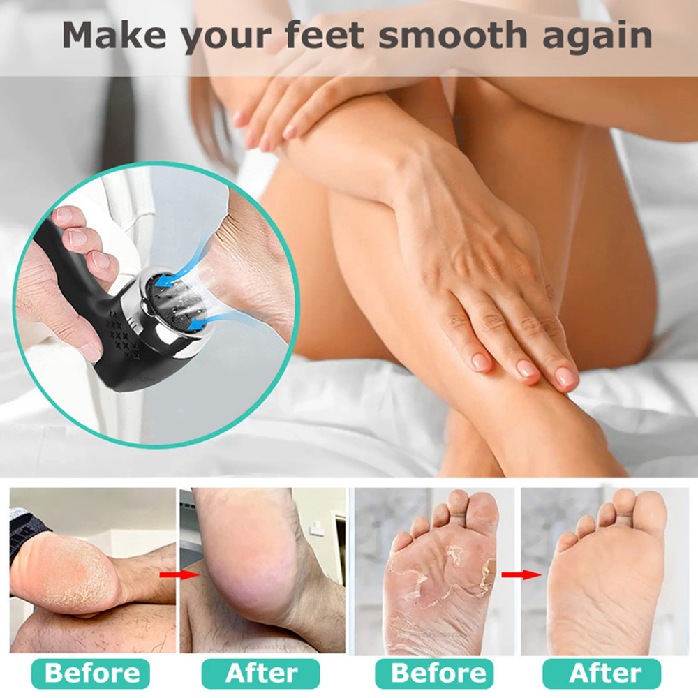 Electric Foot Callus Remover Dust Suction Portable Electronic Foot Hard Skin Foot Grinder