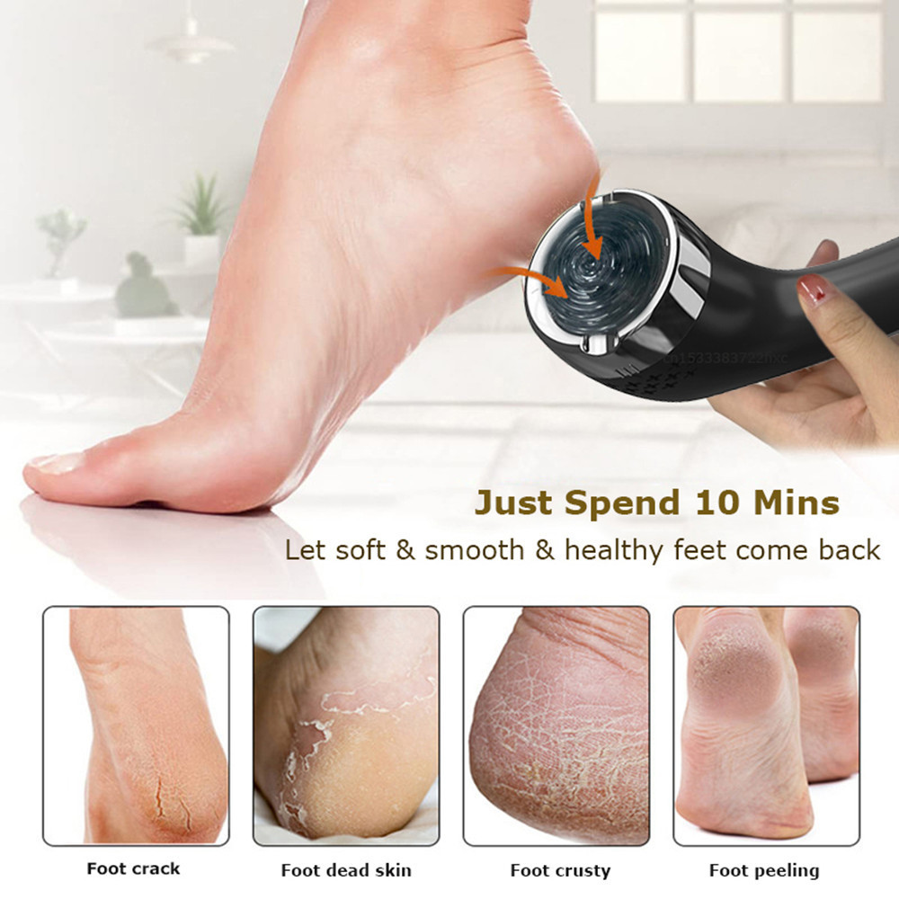 Electric Foot Callus Remover Dust Suction Portable Electronic Foot Hard Skin Foot Grinder