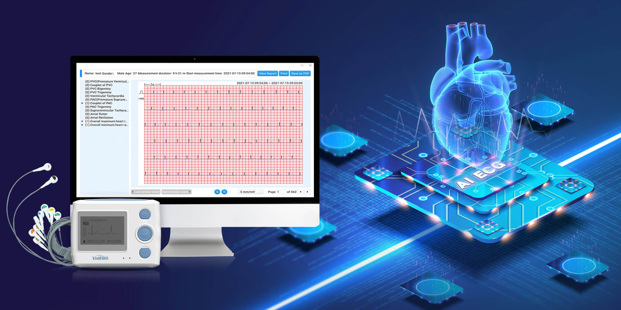 Viatom Th12 12 Lead 24 Hor Portable 12 Channel Holter Recorder Cable Ecg Machine Heart Rate Device Monitor Ekg Electrodes Ecg