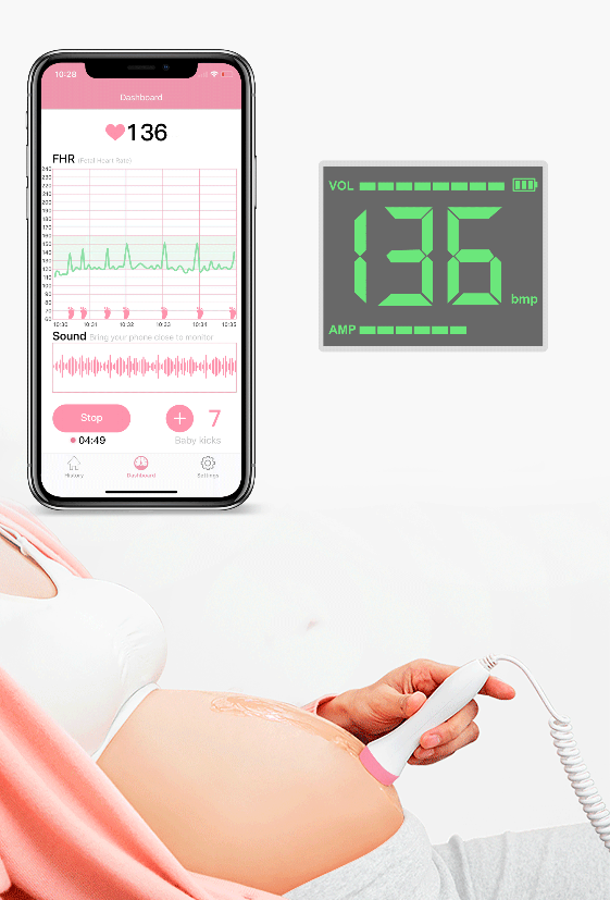 Wellue Babytone  Free App Fetal Doppler  baby heartbeat monitor with New wireless