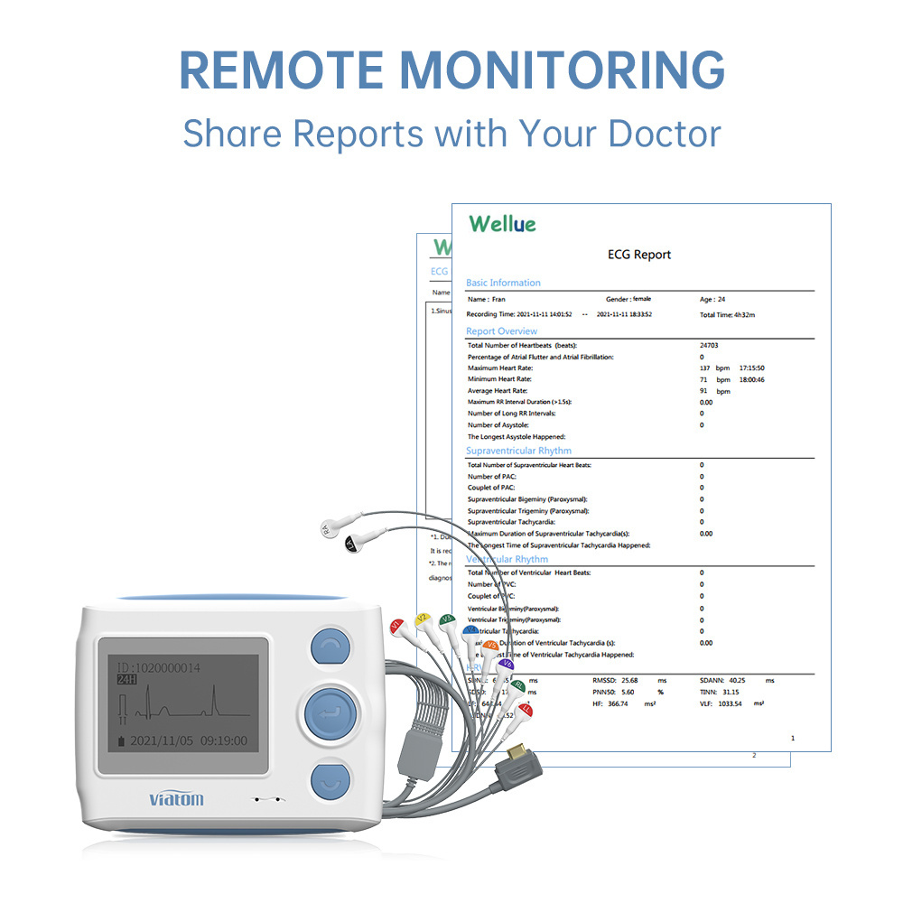 Viatom Th12 12 Lead 24 Hor Portable 12 Channel Holter Recorder Cable Ecg Machine Heart Rate Device Monitor Ekg Electrodes Ecg