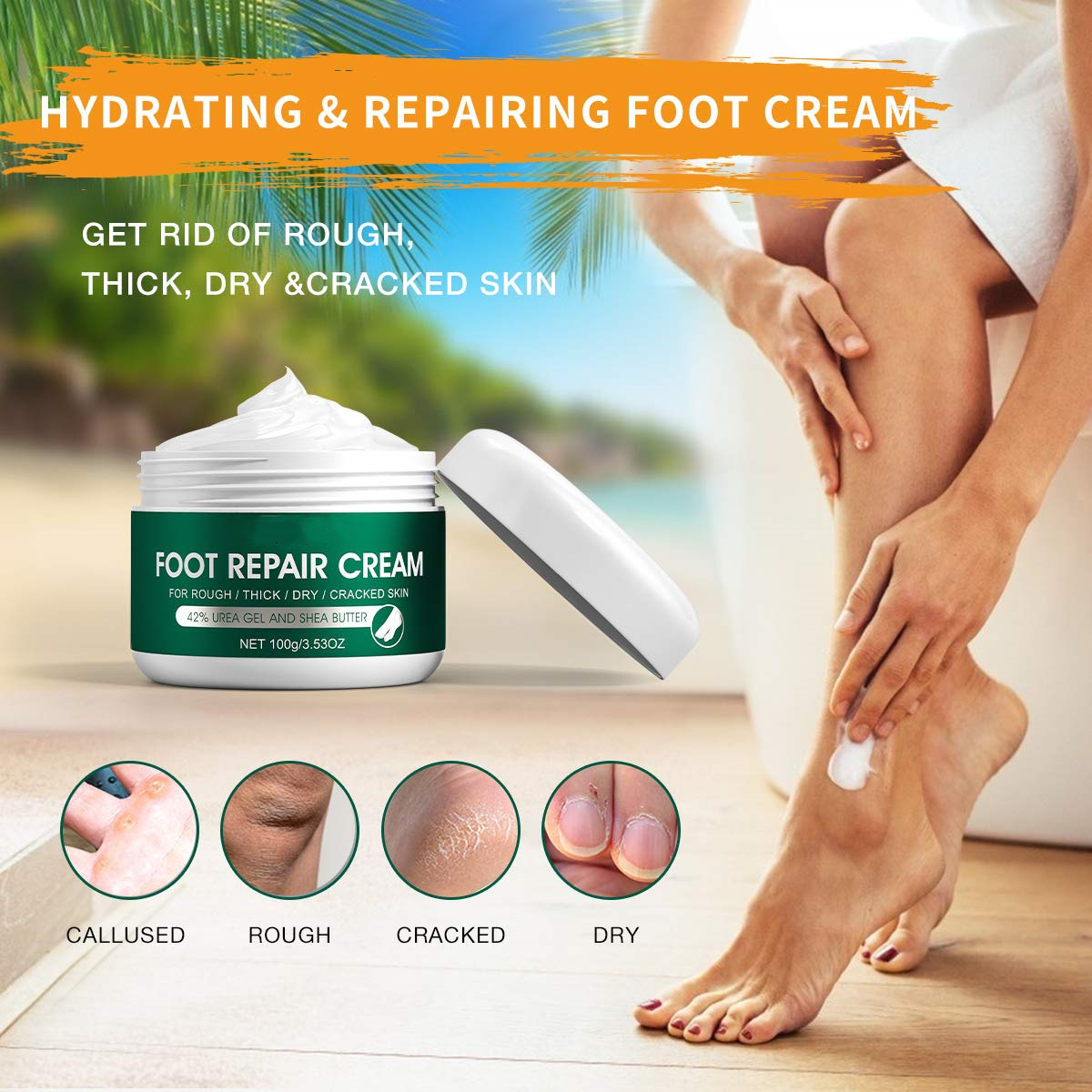 Urea Foot Care Lotion For Cracked Heels , Ultra Rough  Dry Calloused Feet,Softening Rough Skin On Feet