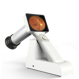 ophthalmic equipment hand held HFC non-mydriatic eye examination fundus camera