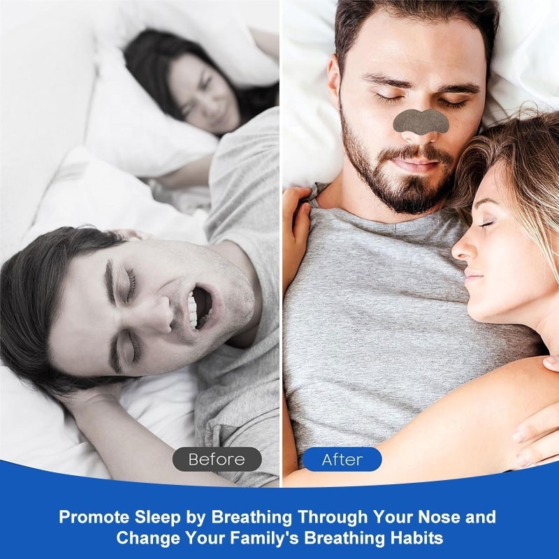 Winstown Nasal patch Wormwood clears the nose sleep in peace natural Chinese herbal Stop snoring stickers Antisnoring plaster