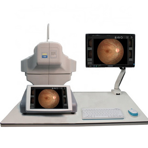 Digital Full automatic auto eye fundus camera fundus fluorescence angiography